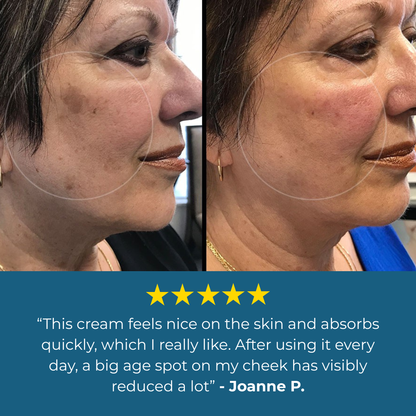 Lavouria Age Spot Cream™