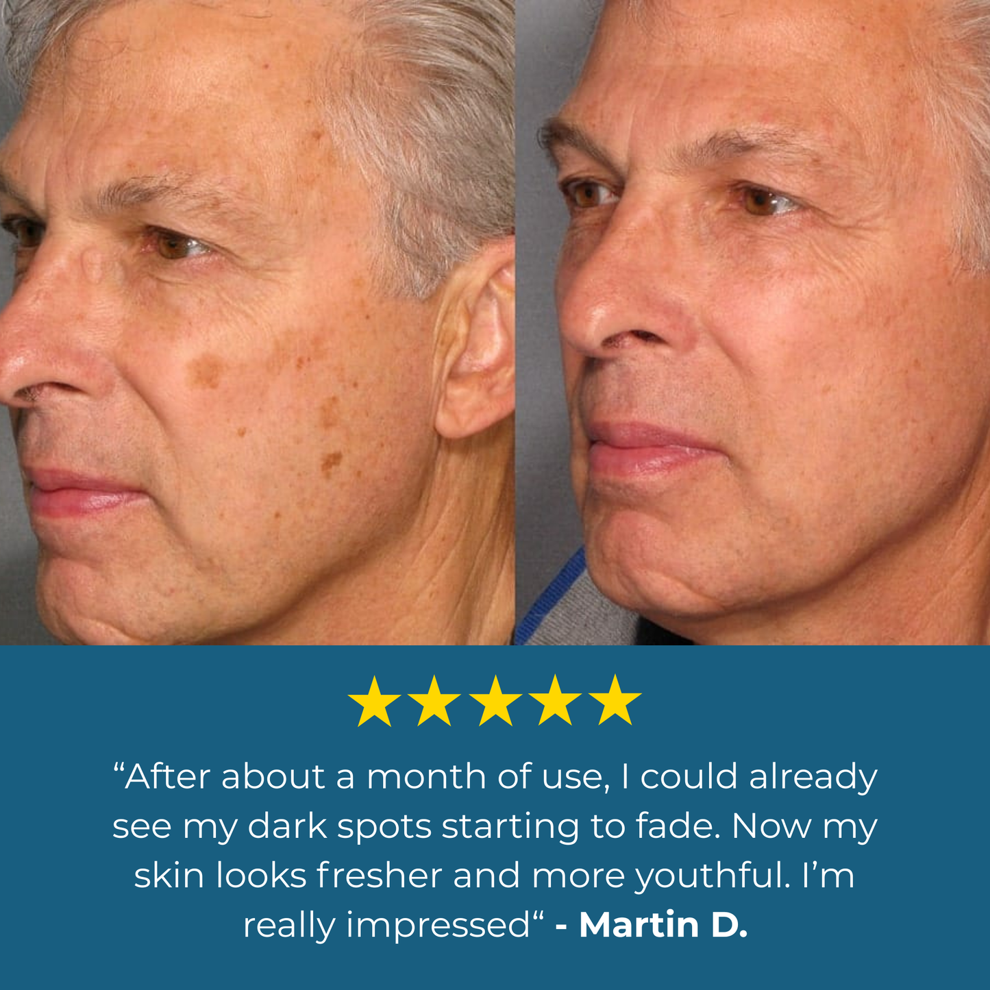 Lavouria Age Spot Cream™