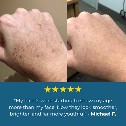 Lavouria Age Spot Cream™