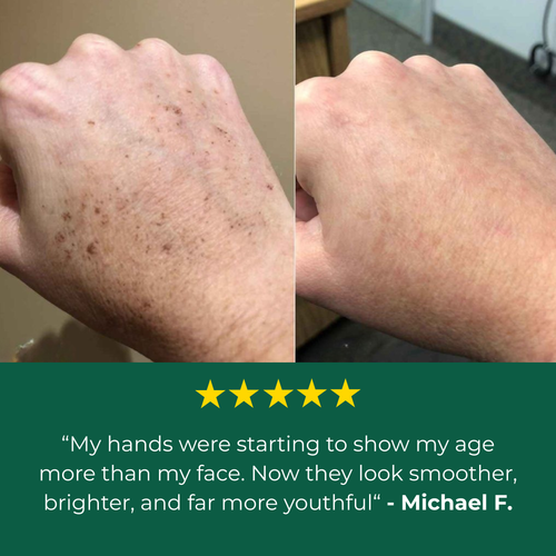 Lavouria Age Spot Cream™