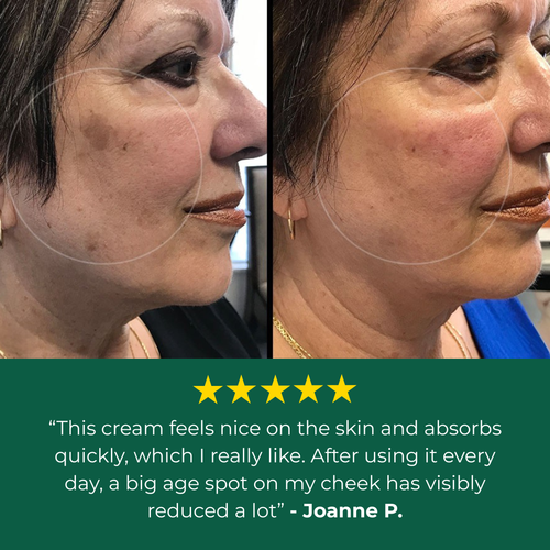 Lavouria Age Spot Cream™