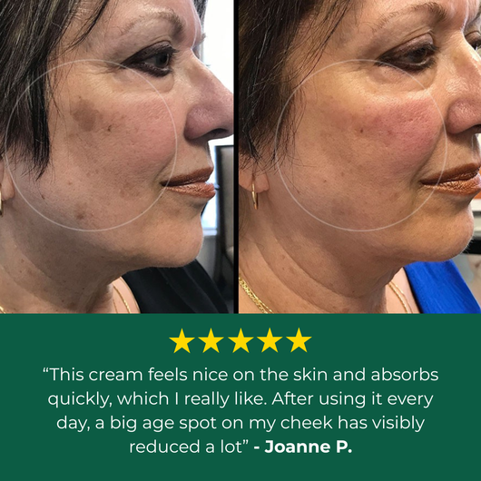 Lavouria Age Spot Cream™