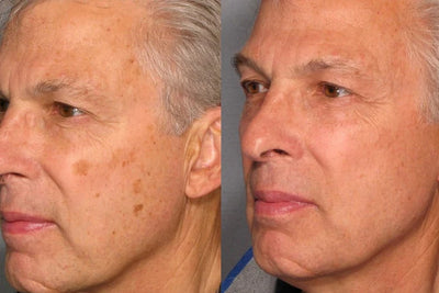 Male customer face before and after