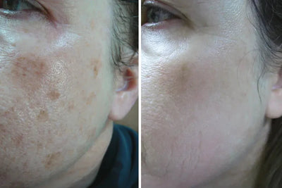 Customer face before and after