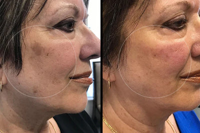 Customer face before and after