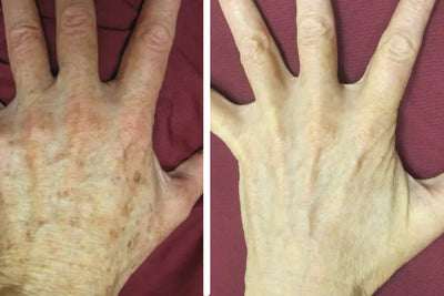 Customer hand before and after
